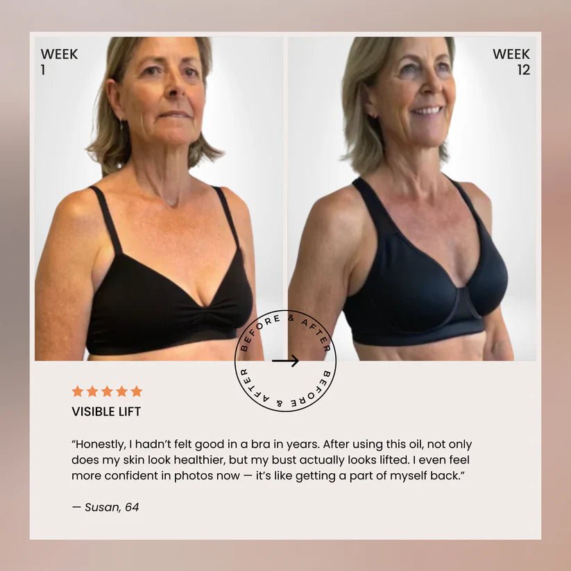 Naturally Lifted, Fuller Bust - Without Surgery, Pills or Padding - Lumier Noir
