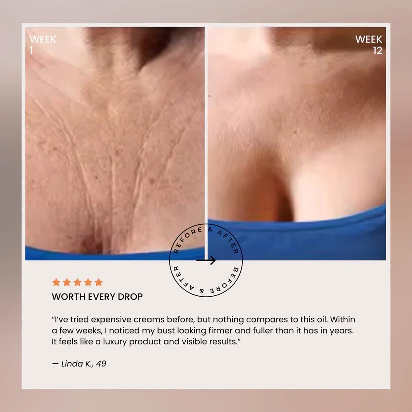 Naturally Lifted, Fuller Bust - Without Surgery, Pills or Padding - Lumier Noir