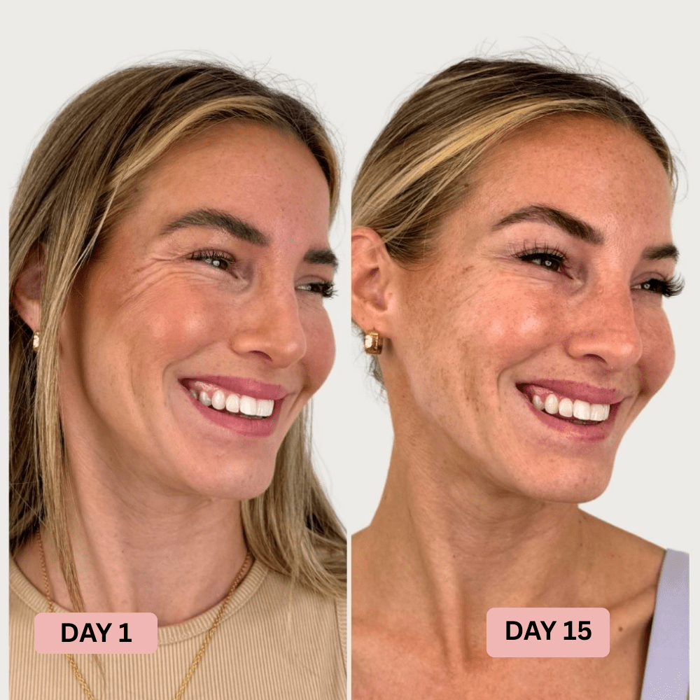 Visibly Firmer, Smoother Skin in 14 Days - Without Injectables - Lumier Noir