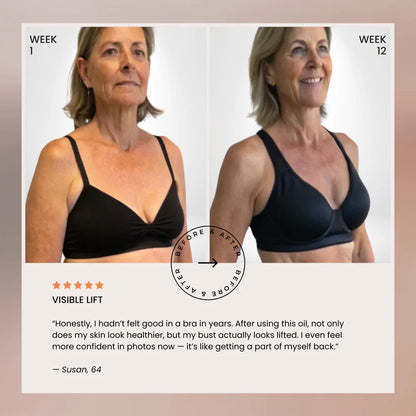 Naturally Lifted, Fuller Bust - Without Surgery, Pills or Padding